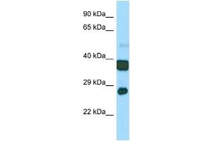 Host:  Rabbit  Target Name:  Atp5c1  Sample Type:  Mouse Stomach lysates  Antibody Dilution:  1. (ATP5C1 抗体  (N-Term))