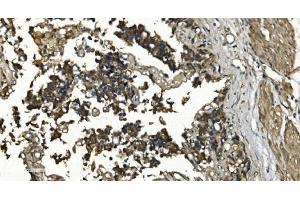 IHC analysis of RGS6 using anti-RGS6 antibody (ABIN7602326).