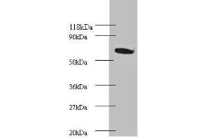 Western blot All lanes: Proteasome subunit beta type-4 Antibody at 2 μg/mL + EC109 whole cell lysate Secondary Goat polyclonal to rabbit IgG at 1/15000 dilution Predicted band size: 30 kDa Observed band size: 75 kDa
