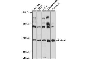 Western blot analysis of extracts of various cell lines, using PNM antibody (4558) at 1:3000 dilution. (PNMA1 抗体  (AA 1-353))