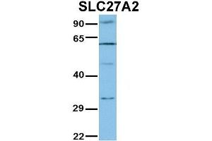 WB Suggested Anti-SLC27A2 Antibody Titration:  1 ug/ml  Positive Control:  Jurkat lysate (SLC27A2 抗体  (N-Term))