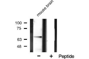 Western blot analysis of PAK1 phosphorylation expression in mouse brain tissue lysates,The lane on the right is treated with the antigen-specific peptide. (PAK1 抗体  (pThr212))