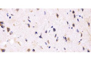 Immunohistochemistry of paraffin-embedded Rat brain using PPP2R4 Polyclonal Antibody at dilution of 1:200 (40x lens).