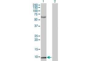 Lane 1: S100A2 transfected lysate ( 10. (S100A2 293T Cell Transient Overexpression Lysate(Denatured))