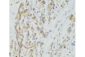 Immunohistochemistry (Paraffin-embedded Sections) (IHC (p)) image for anti-Dicer 1, Ribonuclease Type III (DICER1) antibody (ABIN7010921)