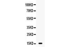 Western blot analysis of GIP expression in MCF-7 whole cell lysates ( Lane 1). (GIP 抗体  (AA 52-93))