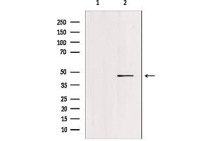 Western blot analysis of extracts from c476, using FOXN2 Antibody. (FOXN2 抗体  (C-Term))