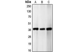 Western blot analysis of p39 expression in SHSY5Y (A), HeLa (B), U87MG (C) whole cell lysates. (p39 (Center) 抗体)