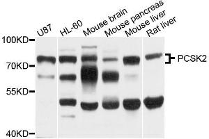 Western blot analysis of extracts of various cell lines, using PCSK2 antibody (ABIN5996172) at 1/1000 dilution. (PCSK2 抗体)