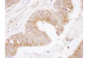 Immunohistochemistry (IHC) image for anti-B-Cell CLL/lymphoma 2 (BCL2) (AA 50-100) antibody (ABIN7454495)