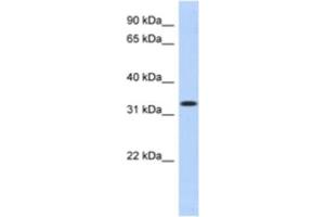 Western Blotting (WB) image for anti-metallophosphoesterase Domain Containing 2 (MPPED2) antibody (ABIN2463910) (MPPED2 抗体)