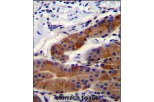 DFNB31 Antibody immunohistochemistry analysis in formalin fixed and paraffin embedded stomach tissue followed by peroxidase conjugation of the secondary antibody and DAB staining. (DFNB31 抗体  (AA 378-406))
