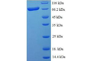 SDS-PAGE (SDS) image for SWI/SNF Related, Matrix Associated, Actin Dependent Regulator of Chromatin, Subfamily B, Member 1 (SMARCB1) (AA 1-494), (full length) protein (His-SUMO Tag) (ABIN5711335)