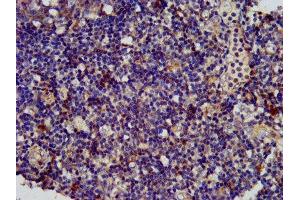 Immunohistochemistry (IHC) image for anti-serine Peptidase Inhibitor, Kazal Type 6 (SPINK6) (AA 24-80) antibody (ABIN7168933)