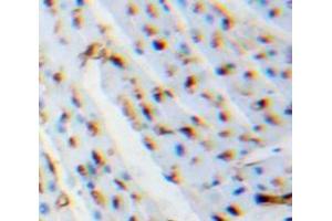 Used in DAB staining on fromalin fixed paraffin-embedded Heart tissue (LGALS1/Galectin 1 抗体  (AA 1-135))