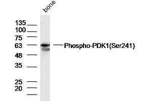 Western Blotting (WB) image for anti-3-phosphoinositide Dependent Protein Kinase-1 (PDPK1) (pSer241) antibody (ABIN744668)