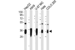 Western Blotting (WB) image for anti-Aldo-keto Reductase Family 1, Member C2 (AKR1C2) (AA 296-323), (C-Term) antibody (ABIN656180)