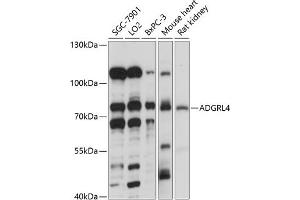 Western Blotting (WB) image for anti-EGF, Latrophilin and Seven Transmembrane Domain Containing 1 (ELTD1) (AA 110-406) antibody (ABIN7266908)
