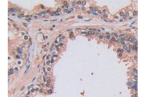 Immunohistochemistry (IHC) image for anti-Lysyl Oxidase-Like 2 (LOXL2) (AA 544-751) antibody (ABIN7438565)