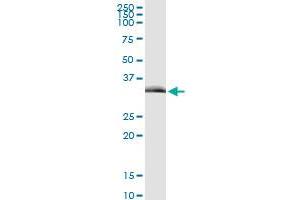 Immunoprecipitation (IP) image for anti-Toll-Interleukin 1 Receptor (TIR) Domain Containing Adaptor Protein (TIRAP) (AA 1-256) antibody (ABIN949800)