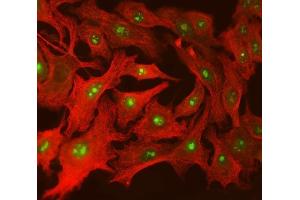 IF analysis of SPT5/SUPT5H using anti-SPT5/SUPT5H antibody (ABIN7601985) and anti-Tubulin beta antibody (ABIN7602744).