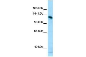 WB Suggested Anti-AMPD2 Antibody Titration: 1. (AMPD2 抗体  (N-Term))