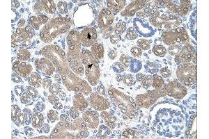 ST3GAL5 antibody was used for immunohistochemistry at a concentration of 4-8 ug/ml.