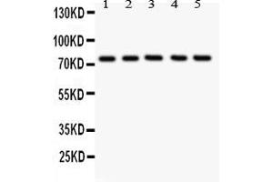 Anti- 12 Lipoxygenase antibody, Western blottingAll lanes: Anti ANOX12  at 0. (ALOX12 抗体  (C-Term))
