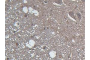 DAB staining on IHC-P; Samples: Rat Spinal cord Tissue (GLRa2 抗体  (AA 28-253))