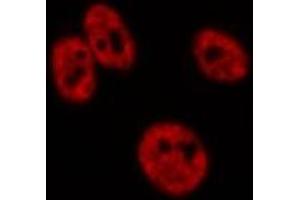ABIN6276724 staining HepG2? (CDK9 抗体  (Internal Region))
