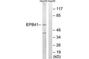 Image no. 1 for anti-Erythrocyte Membrane Protein Band 4.1 (Elliptocytosis 1, RH-Linked) (EPB41) (AA 626-675) antibody (ABIN2889146) (EPB41 抗体  (AA 626-675))