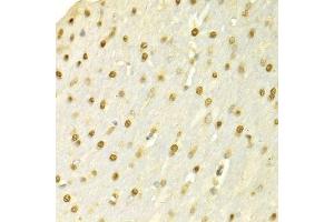 Immunohistochemistry of paraffin-embedded rat brain using SFN Antibody. (14-3-3 sigma/SFN 抗体  (AA 1-248))