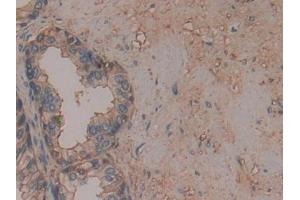 Detection of ANXA6 in Human Prostate Tissue using Polyclonal Antibody to Annexin A6 (ANXA6) (ANXA6 抗体  (AA 2-251))