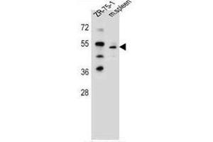 TBX6 Antibody (Center) western blot analysis in ZR-75-1 cell line and mouse spleen tissue lysates (35µg/lane). (T-Box 6 抗体  (Middle Region))