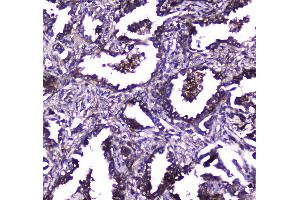 IHC analysis of TLR1 using anti-TLR1 antibody . (TLR1 抗体  (AA 350-404))