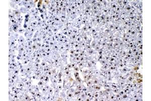 IHC testing of FFPE mouse liver tissue with VEGF Receptor 3 antibody at 1ug/ml. (FLT4 抗体)