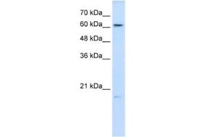 Western Blotting (WB) image for anti-Glutathione Peroxidase 3 (Plasma) (GPX3) antibody (ABIN2462422) (GPX3 抗体)