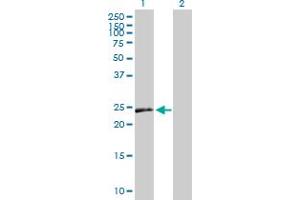 Western Blot analysis of VEGFB expression in transfected 293T cell line by VEGFB MaxPab polyclonal antibody. (VEGFB 抗体  (AA 1-207))