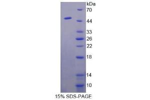 Surfactant Protein A1 (SFTPA1) (AA 112-244) protein (His tag,S tag)