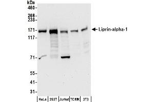 anti-Protein Tyrosine Phosphatase F Interacting Protein 1 (PPFIA1) (AA 550-600) antibody