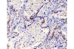 IHC analysis of Integrin alpha 3 using anti-Integrin alpha 3 antibody (ABIN6719410). (ITGA3 抗体)