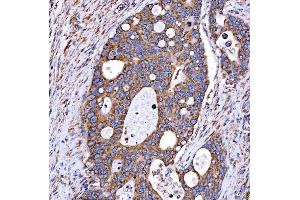 IHC analysis of RAB7/RAB7A using anti-RAB7/RAB7A antibody (ABIN7600597). (RAB7A 抗体  (AA 21-177))