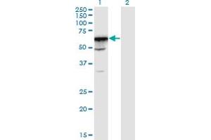 Western Blot analysis of PRPF31 expression in transfected 293T cell line by PRPF31 monoclonal antibody (M02), clone 8E1. (PRPF31 抗体  (AA 400-499))