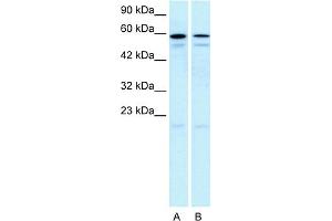WB Suggested Anti-HTR2C Antibody Titration:  5. (HTR2C 抗体  (N-Term))