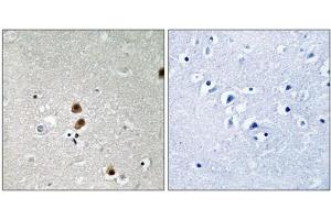 Immunohistochemistry analysis of paraffin-embedded human brain tissue, using CtBP1 (Phospho-Ser422) antibody. (CTBP1 抗体  (pSer422))