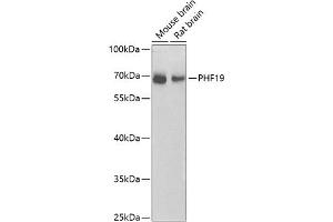 Western blot analysis of extracts of various cell lines, using PHF19 antibody (ABIN6128441, ABIN6145539, ABIN6145540 and ABIN6224090) at 1:1000 dilution. (PHF19 抗体  (AA 1-207))