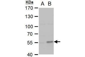 Western Blotting (WB) image for anti-Collagen, Type I, alpha 2 (COL1A2) (C-Term) antibody (ABIN2855530)