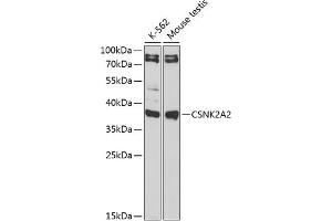 Western blot analysis of extracts of various cell lines, using CSNK2 antibody (ABIN6127663, ABIN6139128, ABIN6139129 and ABIN6217497) at 1:1000 dilution. (CSNK2A2 抗体  (AA 1-350))