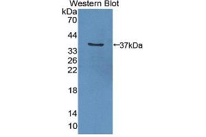 Western blot analysis of the recombinant protein. (GGPS1 抗体  (AA 1-290))
