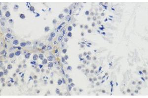 Immunohistochemistry of paraffin-embedded Mouse testis using DiMethyl-Histone H4-K20 Polyclonal Antibody at dilution of 1:200 (40x lens). (Histone H4 抗体  (2meLys20))